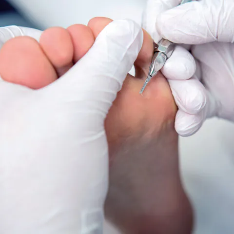 Ostrze do dłuta 2 mm 20 szt First Blades - obrazek 2