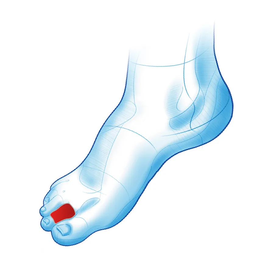 Toe tube – bawełniana osłona na palec - obrazek 2